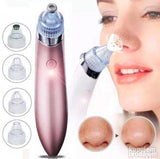 Vakum aparat za lice - Cisti akne i mitisere - Vakum aparat za lice - Cisti akne i mitisere